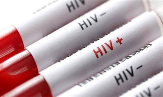 ایدز در کمین زنان؛ زیبایی‌هایی که جان بانوان را تهدید می‌کند