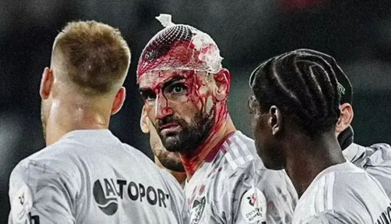 شکستگی سر وحشتناک سردار در دیدار باشاک‌شهیر