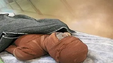 افزایش ۳۳ درصدی مرگ‌ومیر ناشی از سوختگی در آذربایجان شرقی