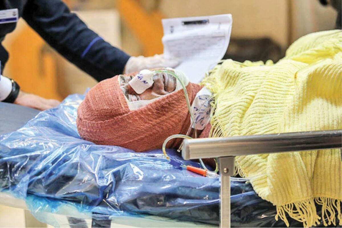 جان‌باختن ۳۰ نفر در بر اثر سوختگی در استان آذربایجان‌غربی